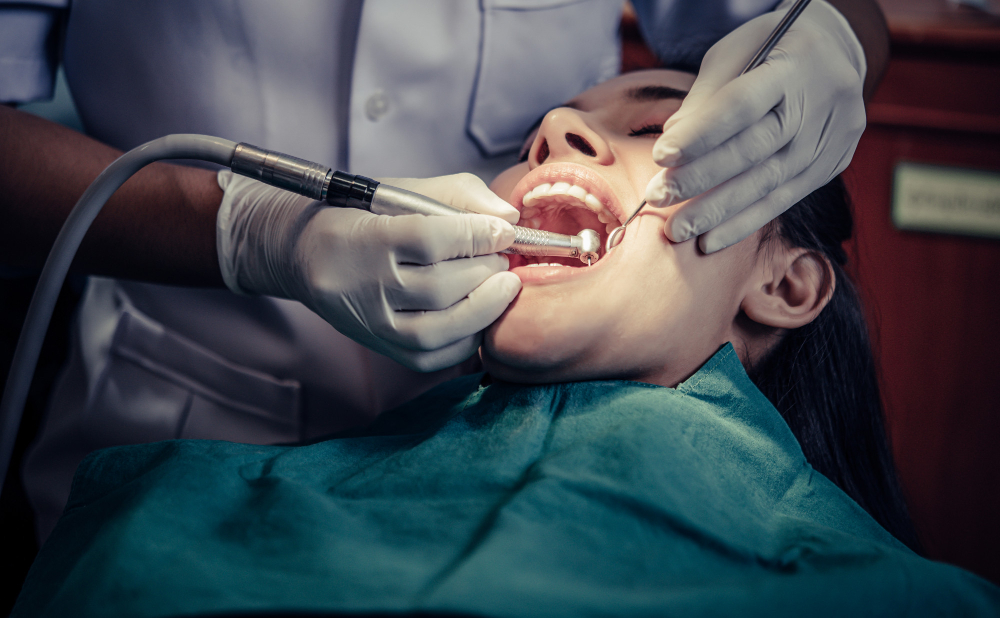 broken tooth Mississauga