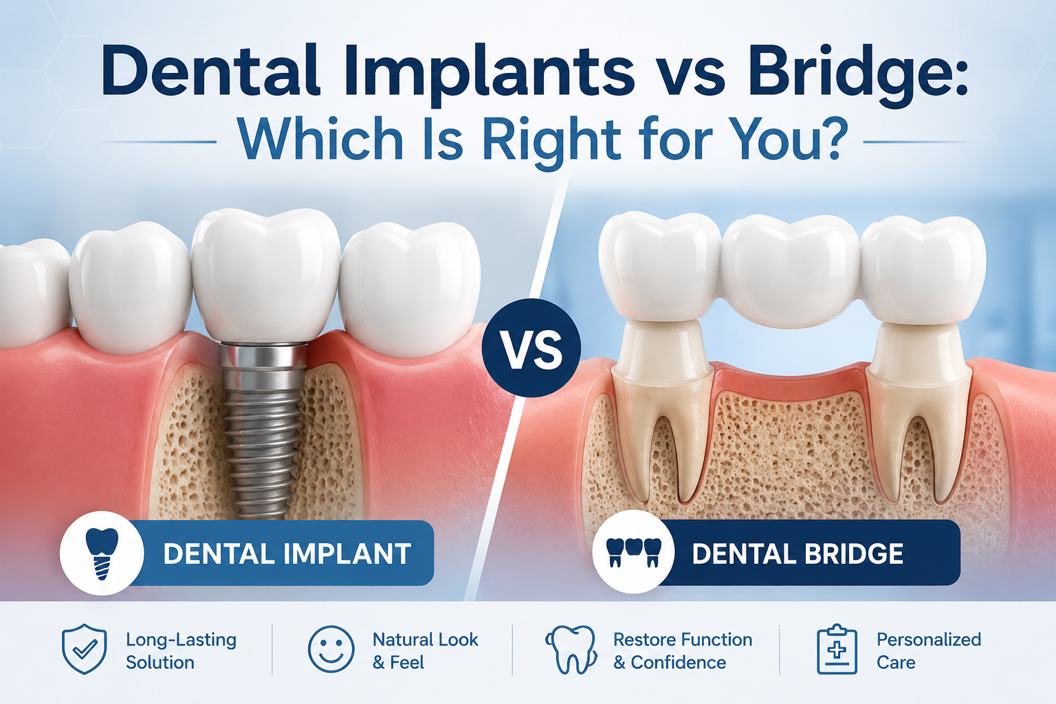 dental implants vs bridge