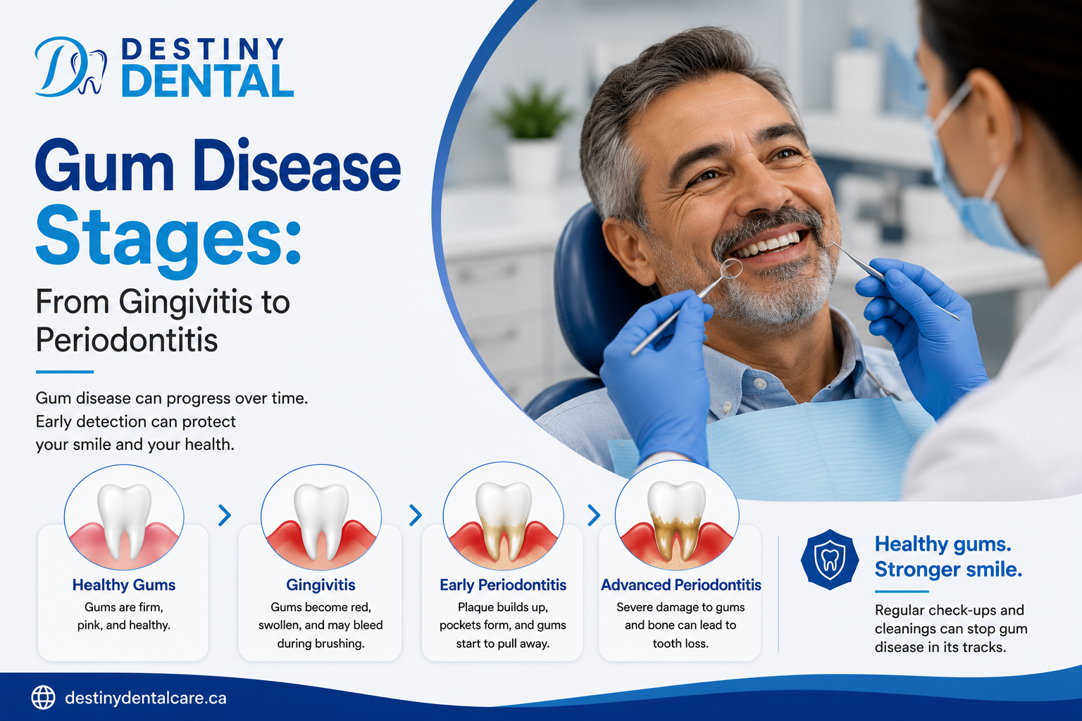 gum disease stages