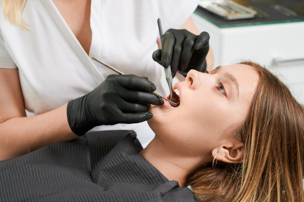 tooth extraction Mississauga